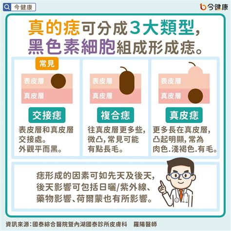 臉上的痣長毛|是痣？皮膚癌？還是什麼？常見Q&A解惑！醫教揪出「。